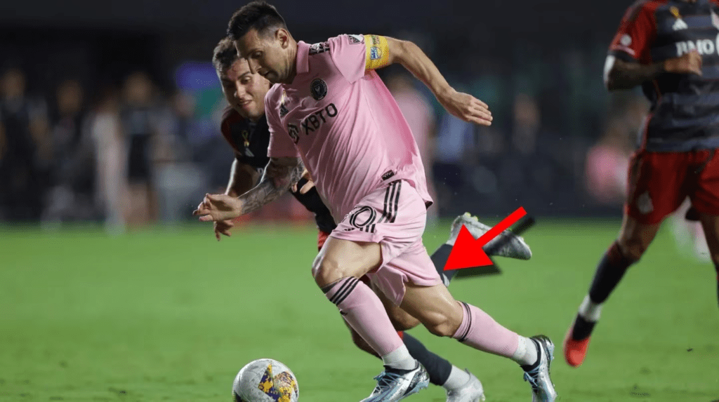 Qué lesión tiene Lionel Messi y el detalle de “una vieja cicatriz” que reveló el Tata Martino