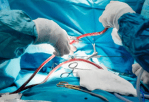 Los cardiólogos alertan por faltantes de stents y otros insumos básicos para cirugías