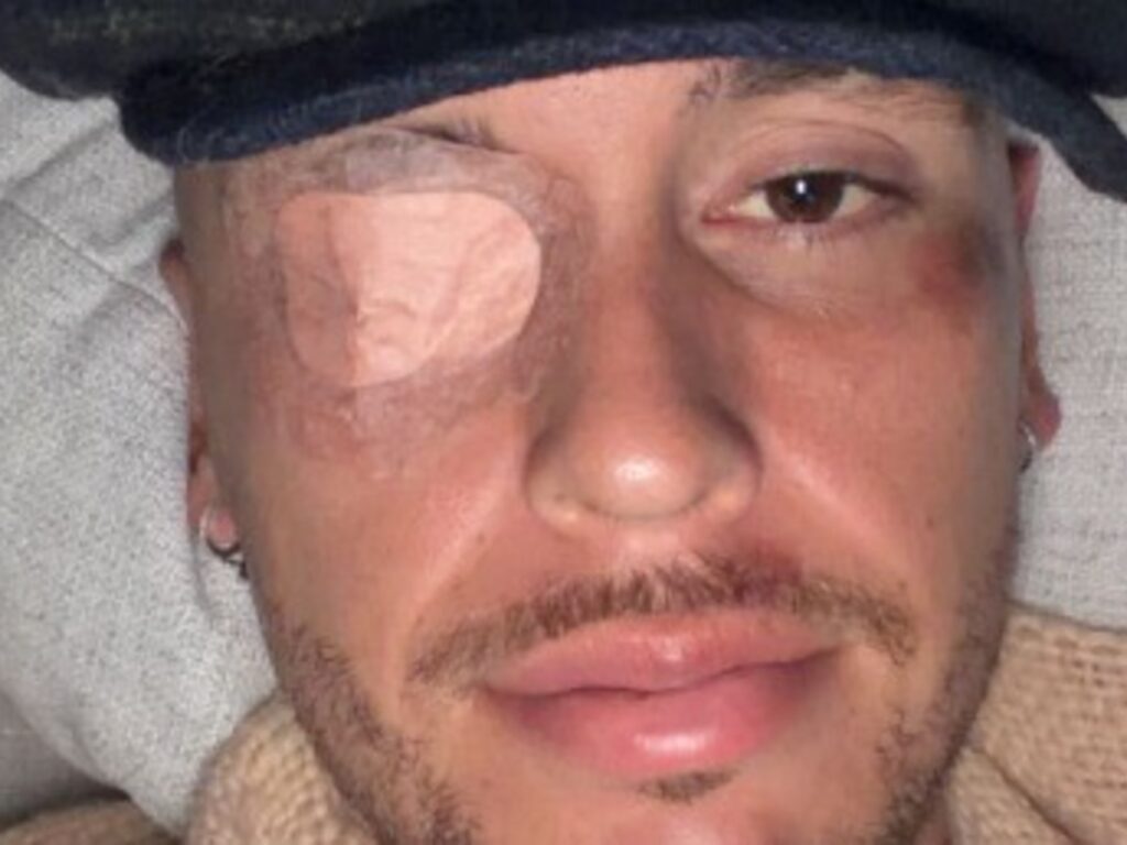 Lucas Ocampos enfrenta crisis de salud: parálisis facial y fractura