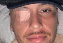 Lucas Ocampos enfrenta crisis de salud: parálisis facial y fractura