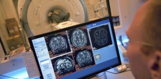 Estudio Revela Prolongadas Secuelas Cerebrales en Ex Atletas Retirados