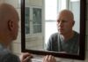 Upadacitinib: 55% recuperó el 80% del cuero cabelludo en alopecia grave Upadacitinib: 55% recuperó el 80% del cuero cabelludo en alopecia grave